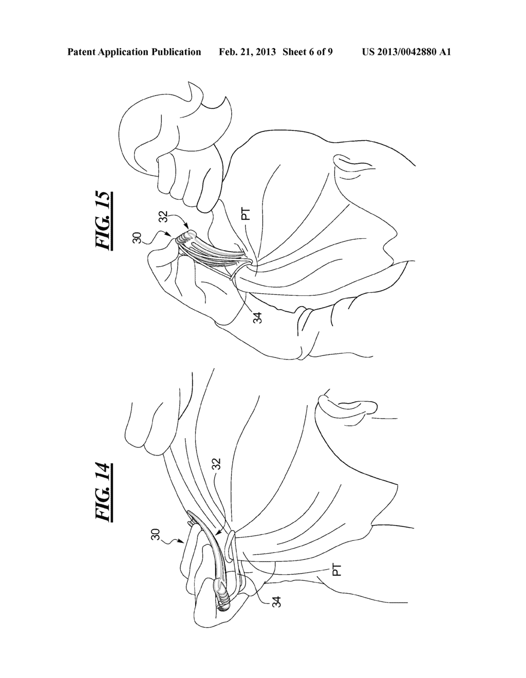 Hairstyling and Style Holding Accessory - diagram, schematic, and image 07