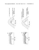 SHIELDED ELECTRICAL CONTACT AND DOPING THROUGH A PASSIVATING DIELECTRIC     LAYER IN A HIGH-EFFICIENCY CRYSTALLINE SOLAR CELL, INCLUDING STRUCTURE     AND METHODS OF MANUFACTURE diagram and image