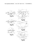 Multi-Slat Combination Blind of Rotating Type diagram and image