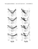 Multi-Slat Combination Blind of Rotating Type diagram and image