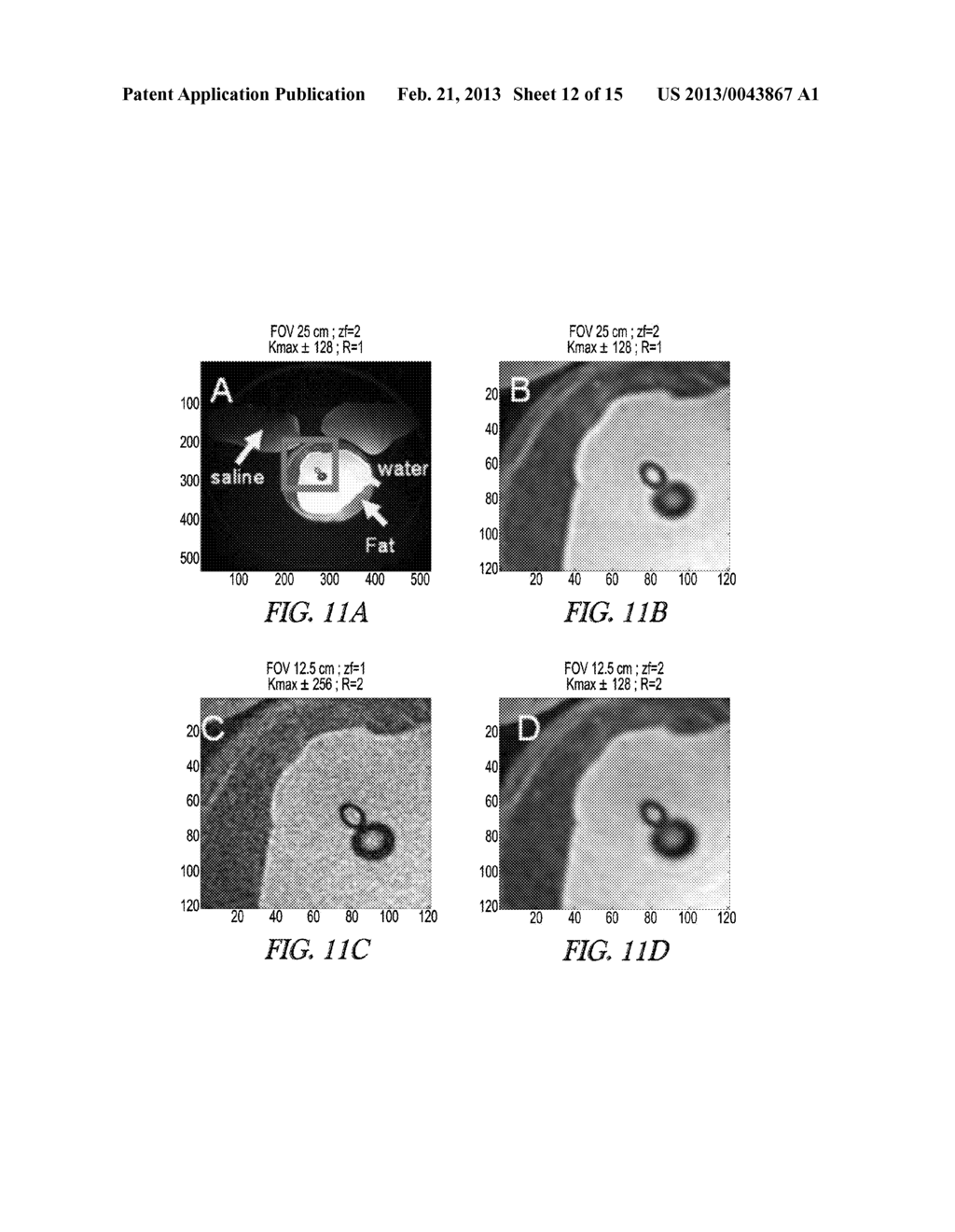 SIDEBAND PROCESSING FOR MAGNETIC RESONANCE - diagram, schematic, and image 13