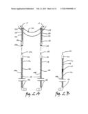 Apparel with built-in headphone extension wire device diagram and image