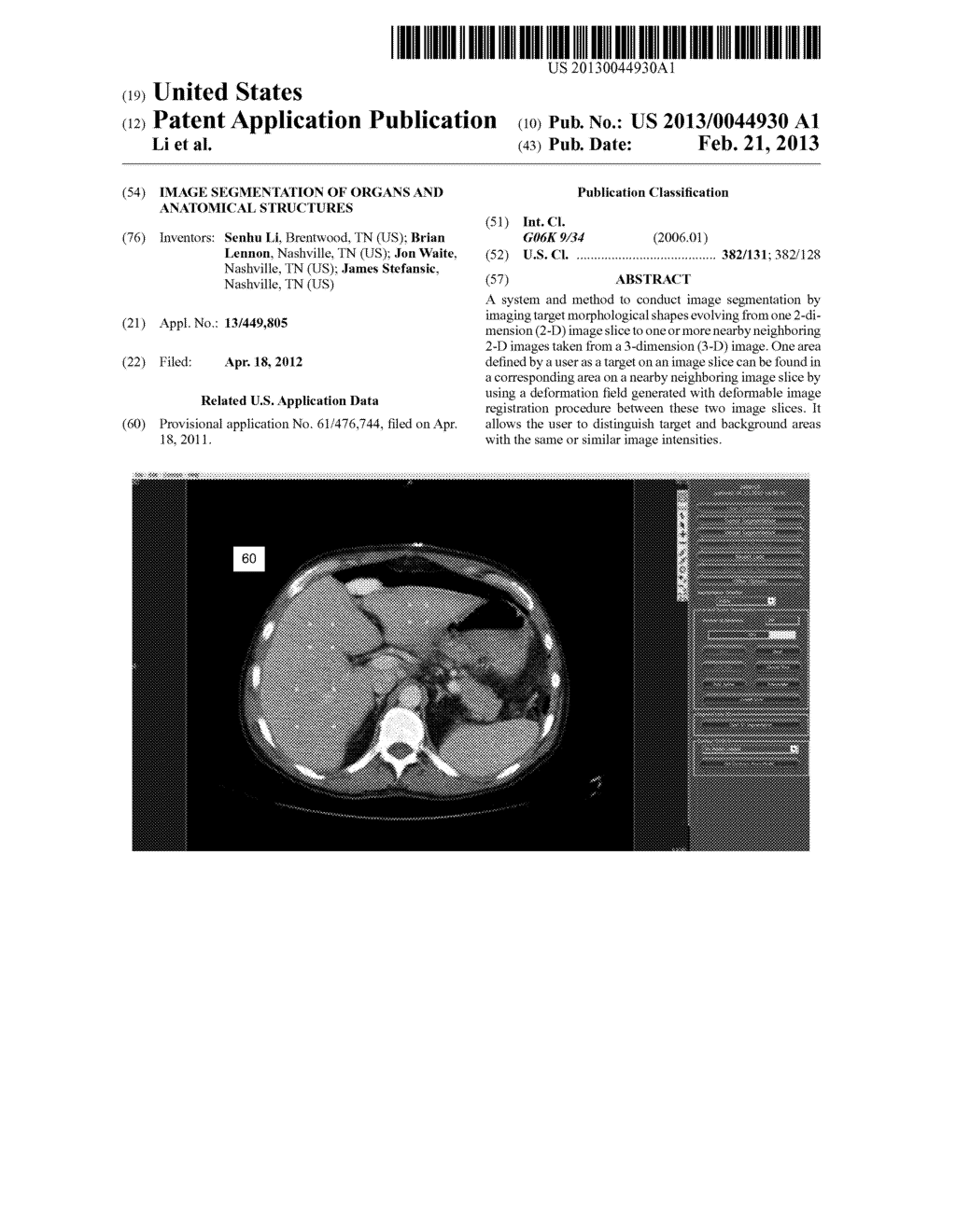 IMAGE SEGMENTATION OF ORGANS AND ANATOMICAL STRUCTURES - diagram, schematic, and image 01