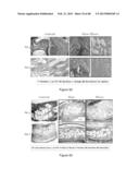 Glycosaminoglycans diagram and image