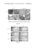 Glycosaminoglycans diagram and image