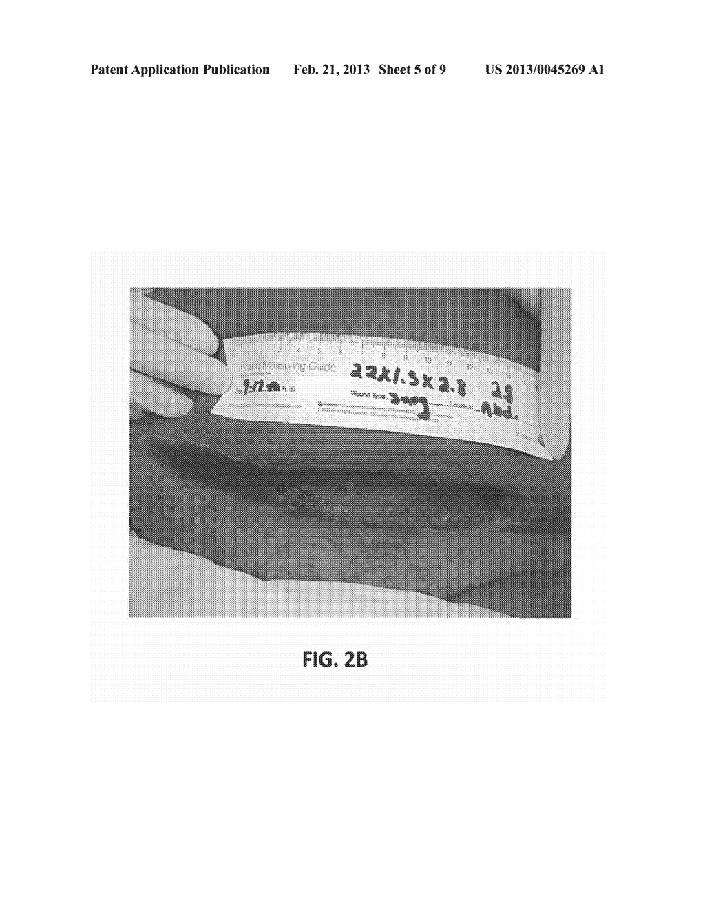 FORMULATIONS AND METHODS FOR WOUND TREATMENT - diagram, schematic, and image 06