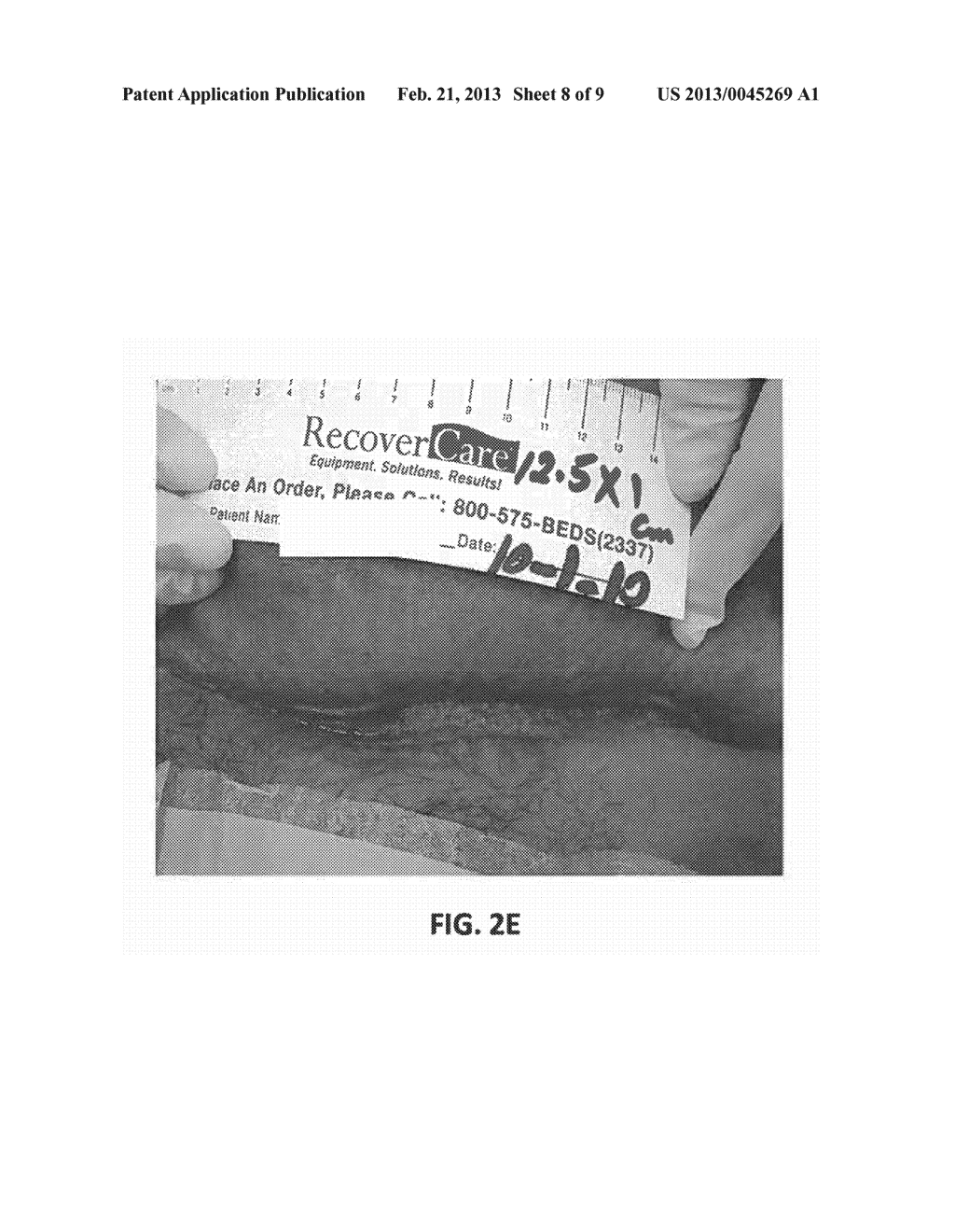 FORMULATIONS AND METHODS FOR WOUND TREATMENT - diagram, schematic, and image 09