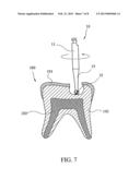 STAINLESS STEEL BUR diagram and image