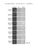 YEAST CELLS EXPRESSING AMYLOID BETA AND USES THEREFOR diagram and image