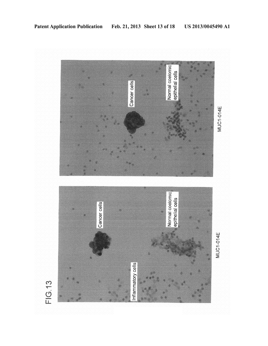 ANTIBODY AGAINST MUCIN 1 (MUC1) PROTEIN AND USE OF SAME - diagram, schematic, and image 14