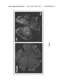 THERAPEUTIC COMPOSITIONS FOR THE TREATMENT OF DRY EYE DISEASE diagram and image