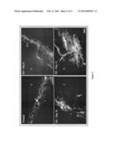 THERAPEUTIC COMPOSITIONS FOR THE TREATMENT OF DRY EYE DISEASE diagram and image