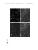 PLA2ACTIVITY AS A MARKER FOR OVARIAN AND OTHER GYNECOLOGIC CANCERS diagram and image