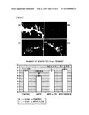 PHARMACEUTICAL COMPOSITION FOR INHIBITING APOPTOSIS OF NEURON OR     NEURODEGENERATION diagram and image