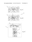 SURGICAL INSTRUMENT AND METHOD WITH MULTIPLE IMAGE CAPTURE SENSORS diagram and image