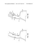 Cap for Attachment to an Endoscope diagram and image