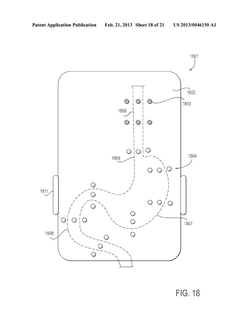 Method for diagnosis and treatment of disorders of the gastrointestinal     tract, and apparatus for use therewith - diagram, schematic, and image 19