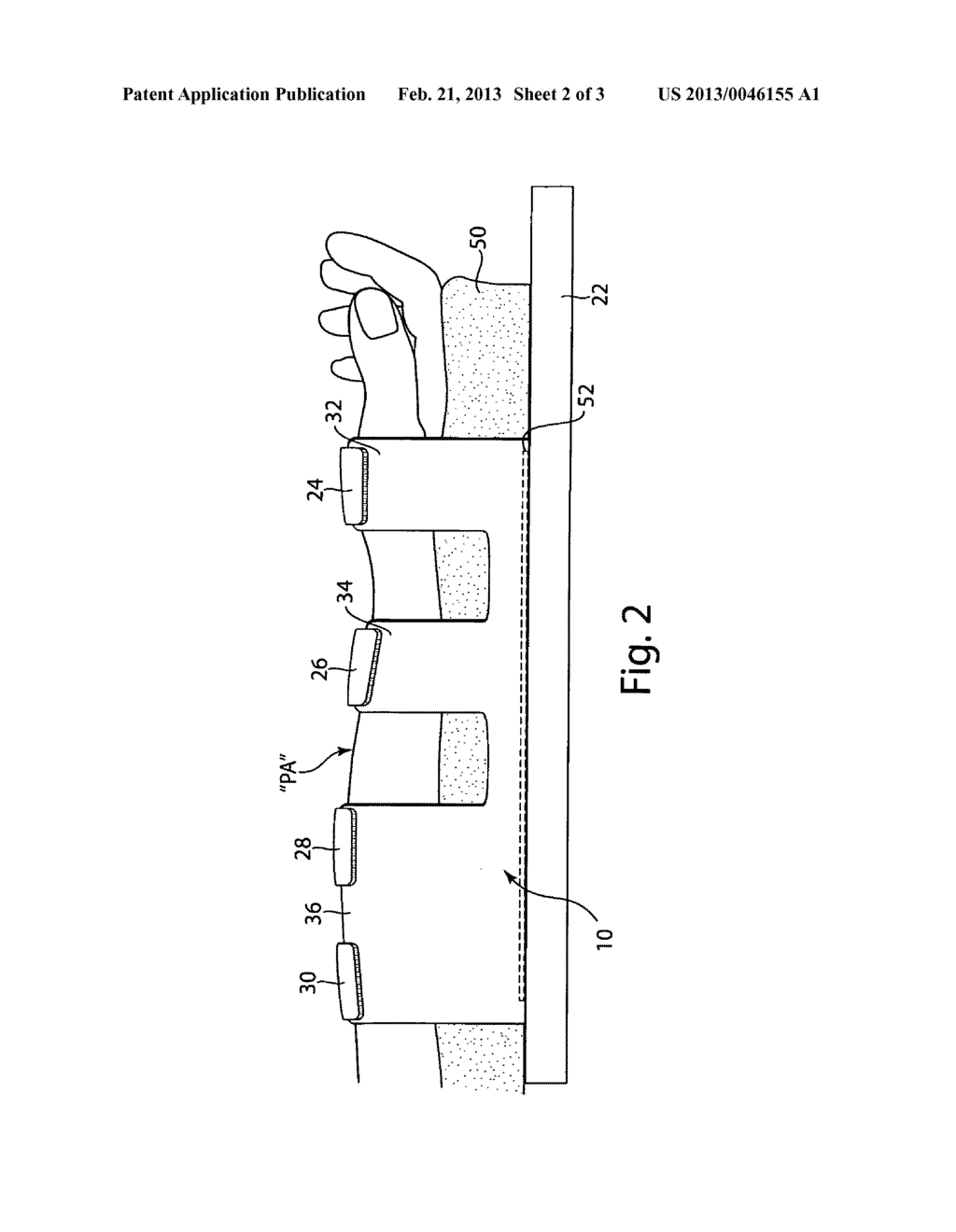 Arm board patient securement arrangement - diagram, schematic, and image 03