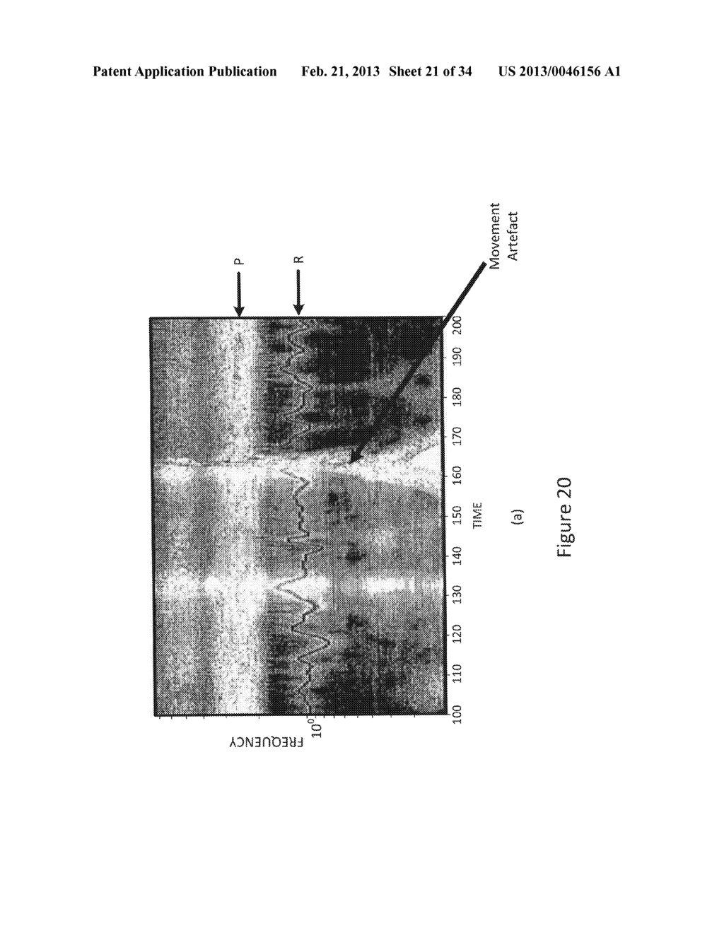 METHOD OF ANALYZING AND PROCESSING SIGNALS - diagram, schematic, and image 22