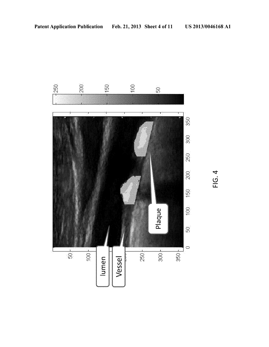 METHOD AND SYSTEM OF CHARACTERIZATION OF CAROTID PLAQUE - diagram, schematic, and image 05