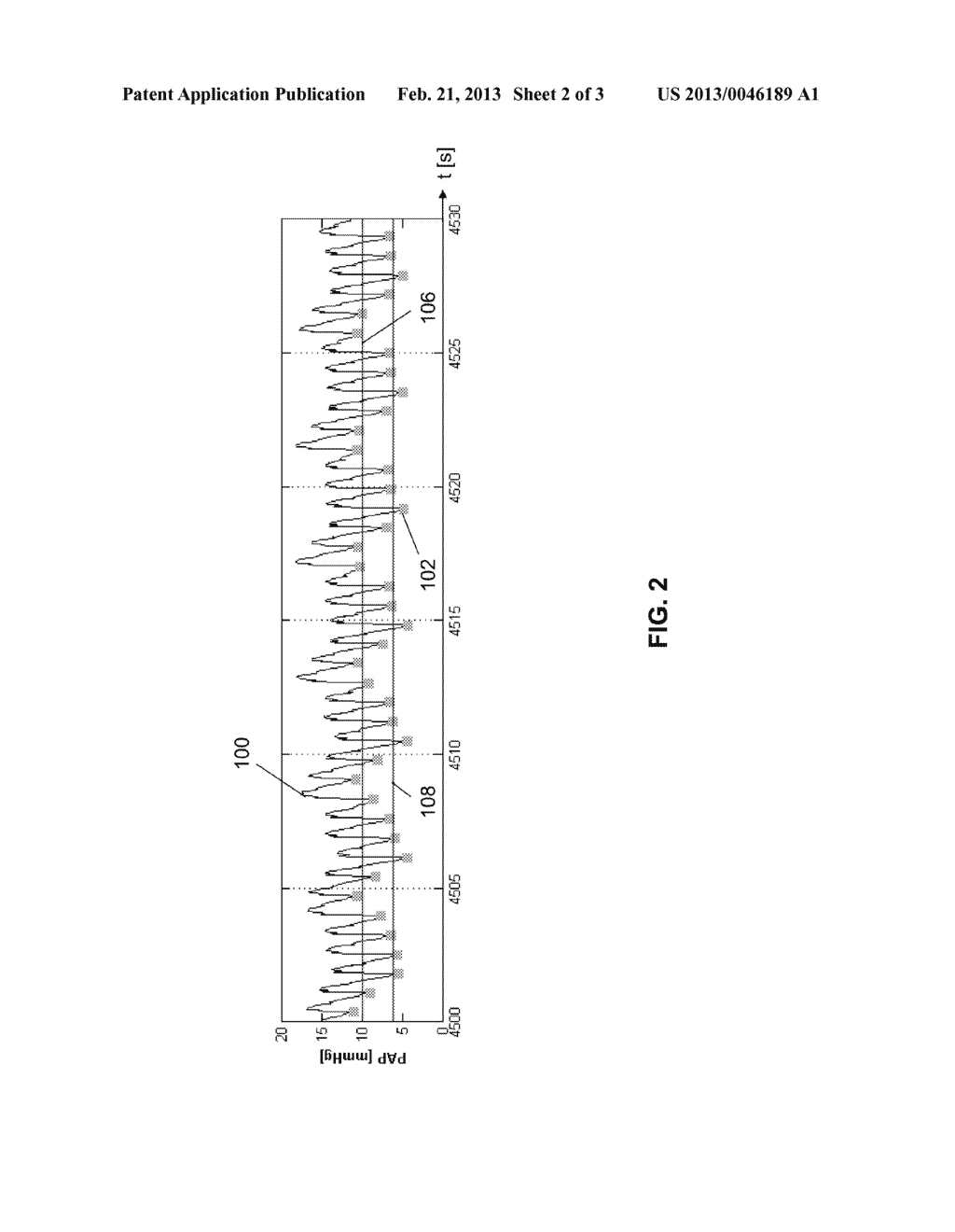 METHOD AND IMPLANTABLE MEDICAL SYSTEM FOR MONITORING RESPIRATORY     PARAMETERS AND A CORRESPONDING COMPUTER PROGRAM AND A CORRESPONDING     COMPUTER-READABLE STORAGE MEDIUM - diagram, schematic, and image 03