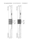 Arrhythmia Classification diagram and image