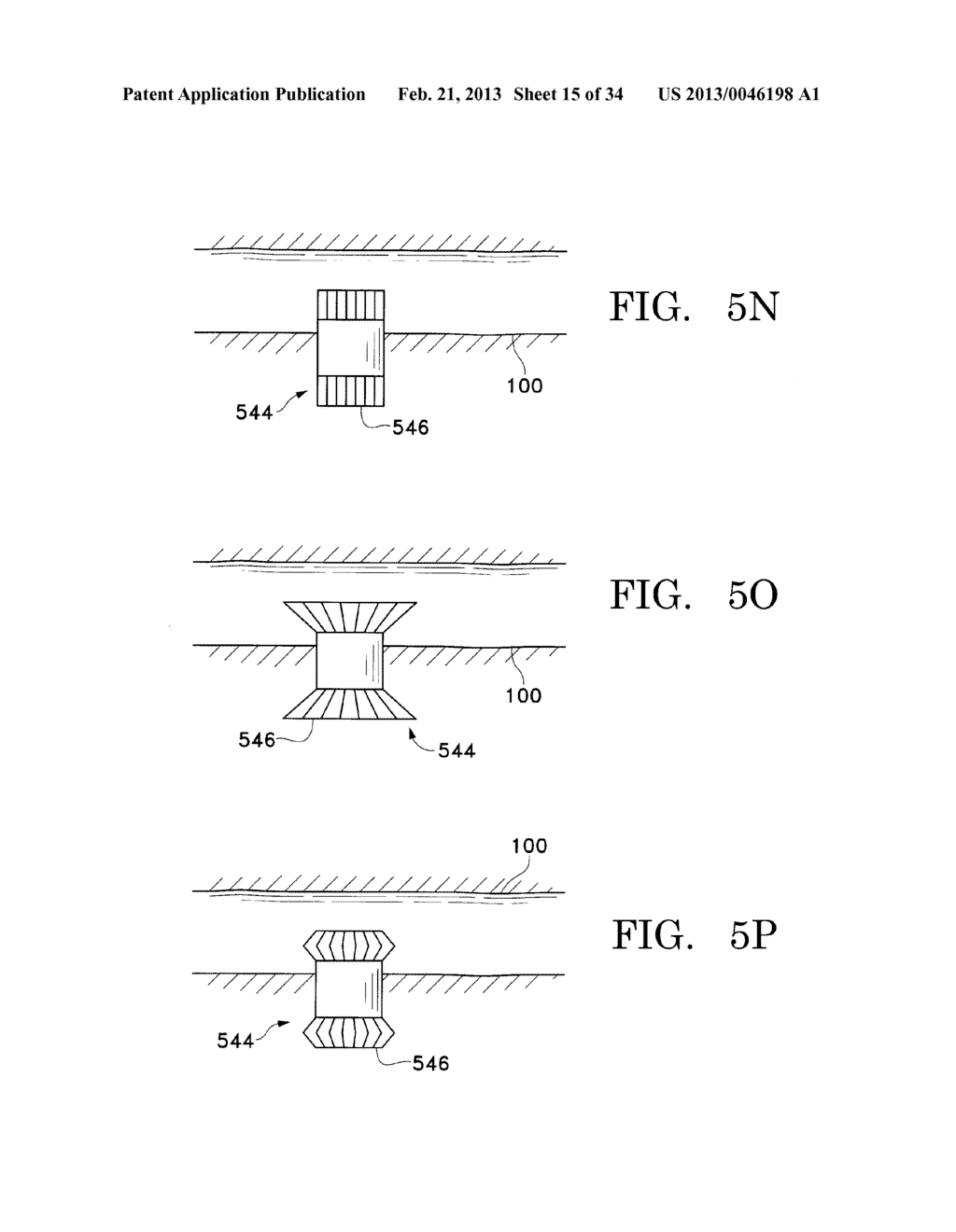 METHODS FOR MAINTAINING THE PATENCY OF COLLATERAL CHANNELS IN THE LUNGS     USING CRYO-ENERGY - diagram, schematic, and image 16