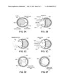 MECHANICAL ACTUATOR FOR A VESTIBULAR STIMULATOR diagram and image