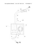 SYSTEMS AND METHODS FOR PROVIDING A CHANNEL THROUGH AN ORTHOPEDIC CAST diagram and image