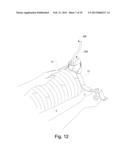 SYSTEMS AND METHODS FOR PROVIDING A CHANNEL THROUGH AN ORTHOPEDIC CAST diagram and image