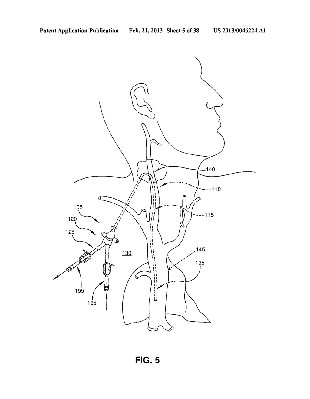 METHOD AND APPARATUS FOR THE DIALYSIS OF BLOOD - diagram, schematic, and image 06