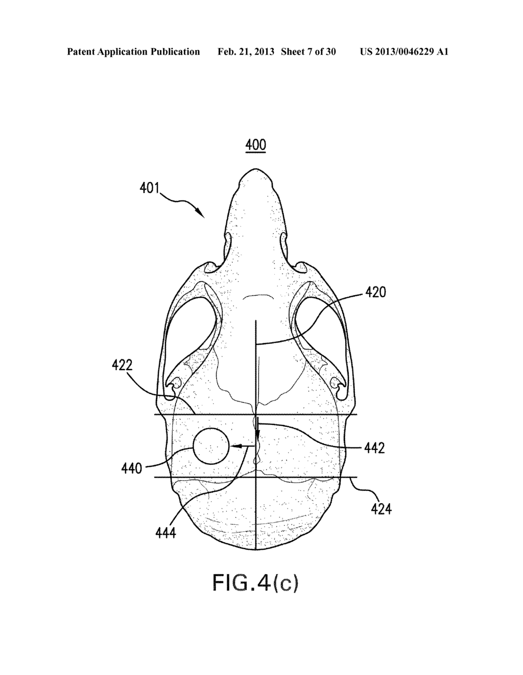 SYSTEMS AND METHODS FOR OPENING OF A TISSUE BARRIER - diagram, schematic, and image 08