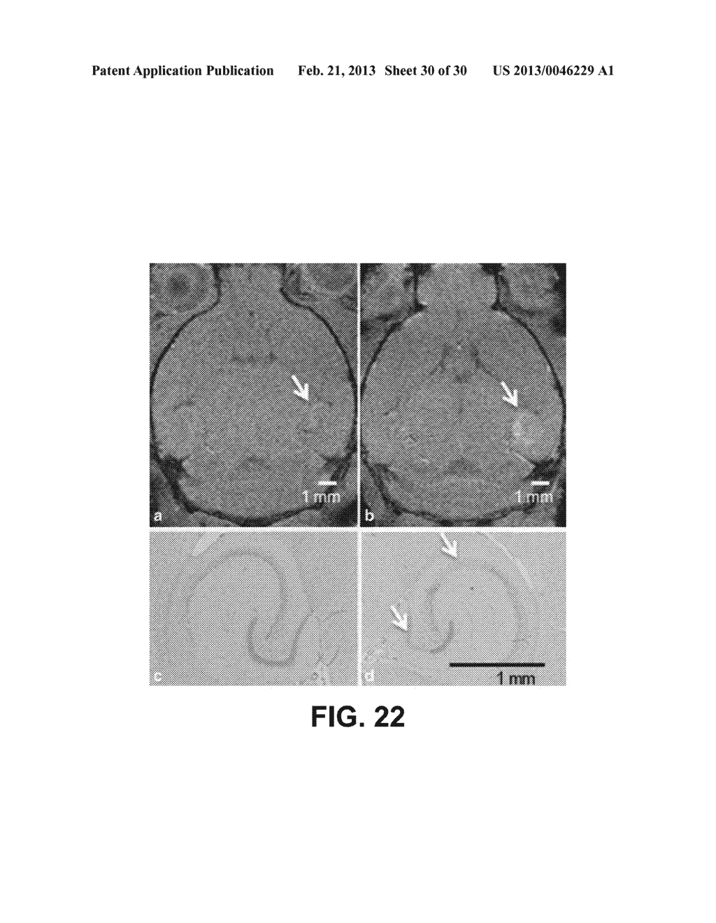 SYSTEMS AND METHODS FOR OPENING OF A TISSUE BARRIER - diagram, schematic, and image 31