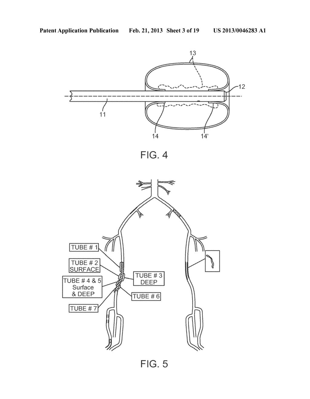 METHODS AND INTRAVASCULAR TREATMENT DEVICES FOR TREATMENT OF     ATHEROSCLEROSIS - diagram, schematic, and image 04