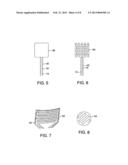 Ablation Cap diagram and image