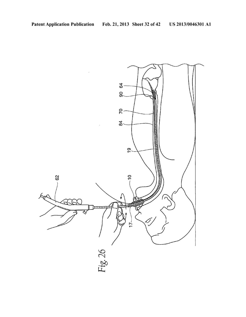 SYSTEMS AND METHODS EMPLOYING A BITE BLOCK INSERT FOR POSITIONING AND     STABILIZING EXTERNAL INSTRUMENTS DEPLOYED WITHIN THE BODY - diagram, schematic, and image 33