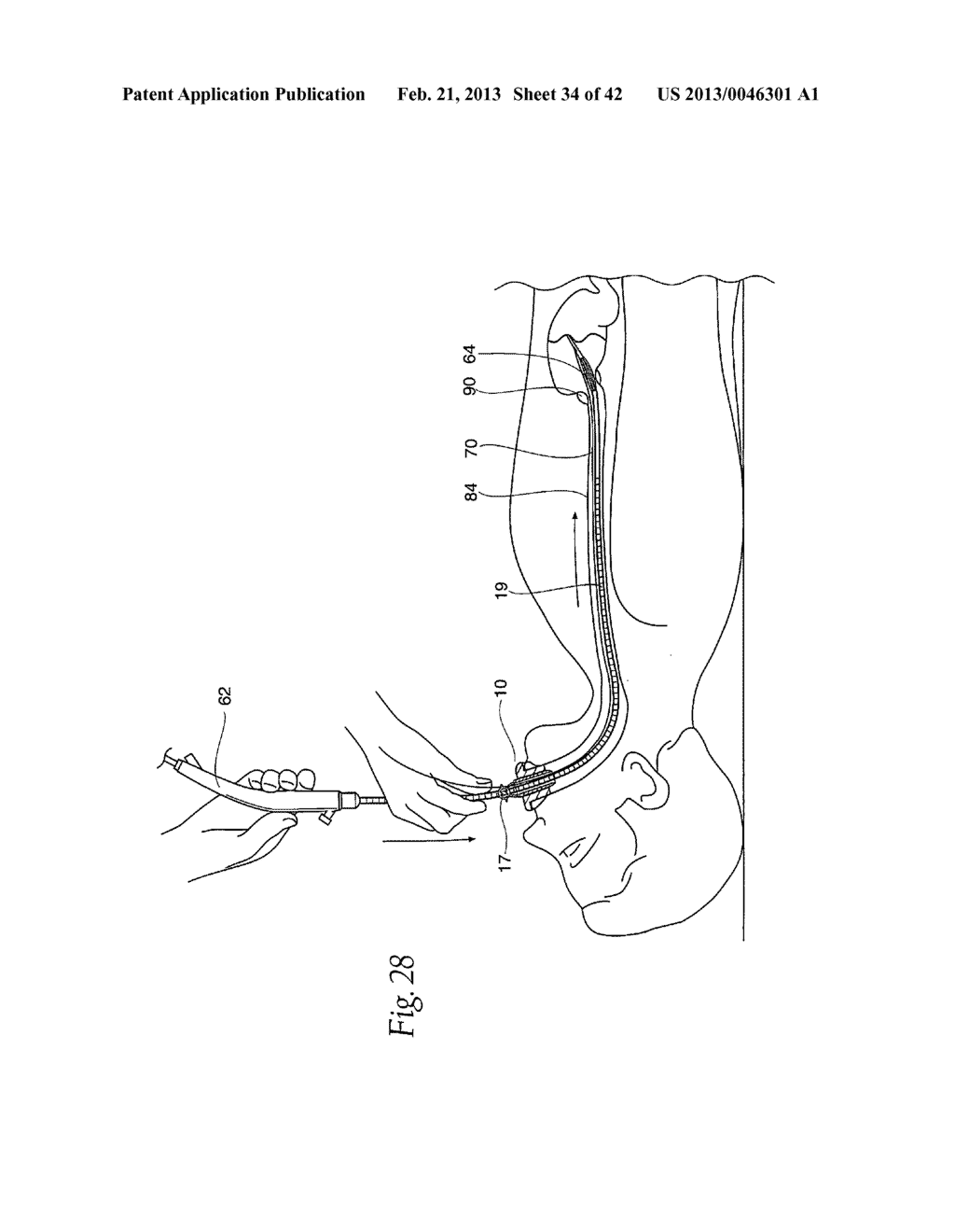 SYSTEMS AND METHODS EMPLOYING A BITE BLOCK INSERT FOR POSITIONING AND     STABILIZING EXTERNAL INSTRUMENTS DEPLOYED WITHIN THE BODY - diagram, schematic, and image 35