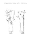 HOLDER/IMPACTOR FOR CONTOURED BONE PLATE FOR FRACTURE FIXATION diagram and image