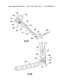 HOLDER/IMPACTOR FOR CONTOURED BONE PLATE FOR FRACTURE FIXATION diagram and image