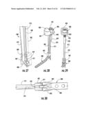 HOLDER/IMPACTOR FOR CONTOURED BONE PLATE FOR FRACTURE FIXATION diagram and image