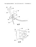 HOLDER/IMPACTOR FOR CONTOURED BONE PLATE FOR FRACTURE FIXATION diagram and image