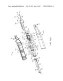 TISSUE REMOVAL SYSTEM diagram and image