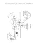 TISSUE REMOVAL SYSTEM diagram and image