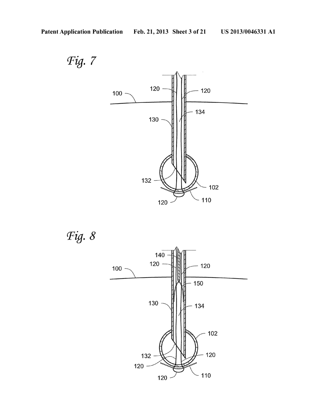 BODY LUMEN OCCLUSION APPARATUS AND METHODS - diagram, schematic, and image 04