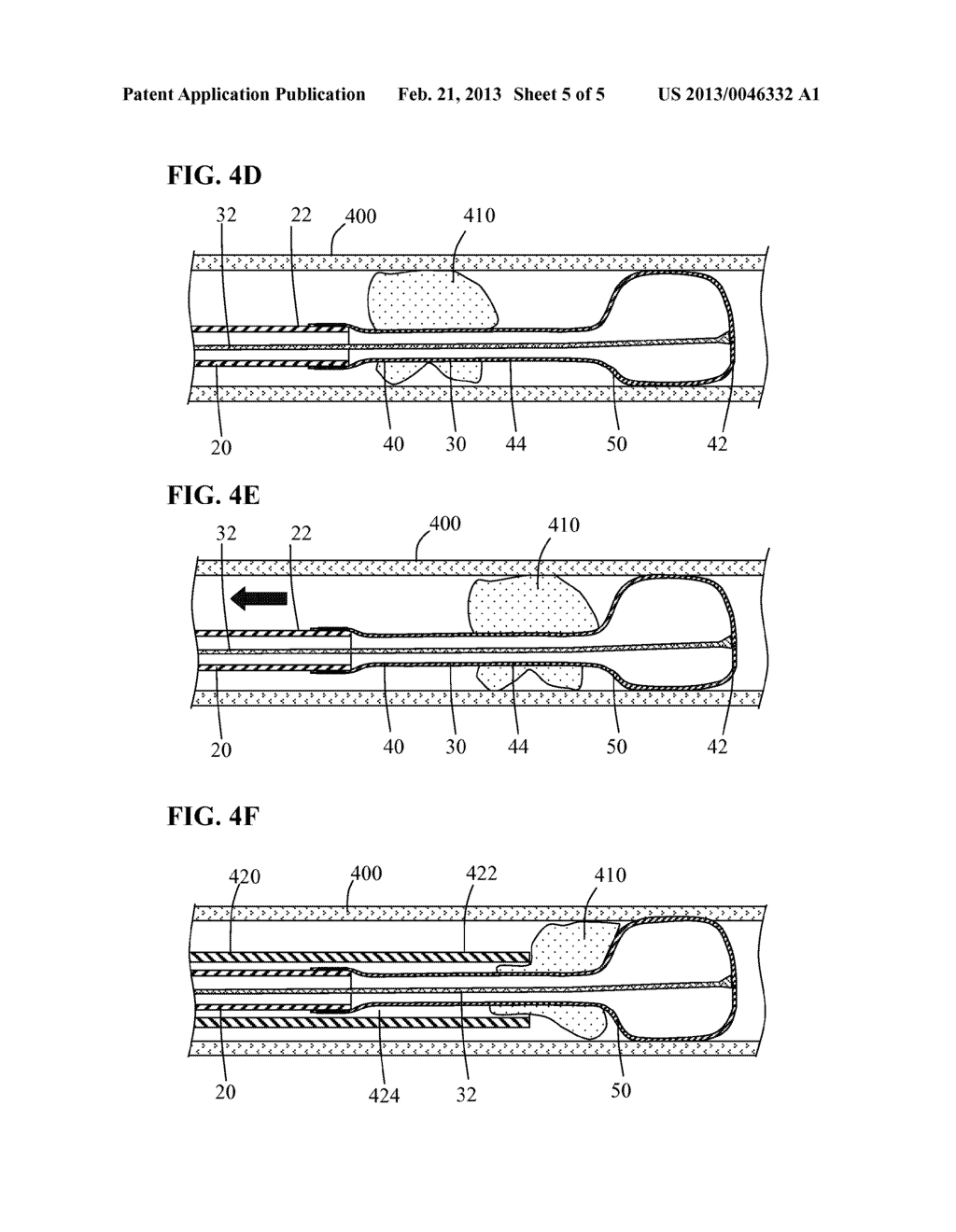 METHODS AND SYSTEMS FOR PERFORMING THROMBECTOMY PROCEDURES - diagram, schematic, and image 06