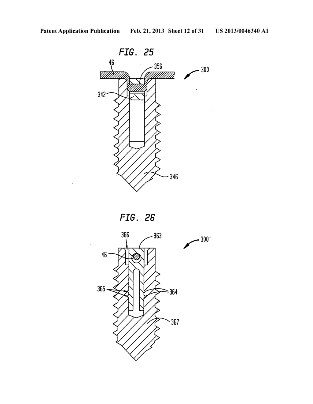 MEDICAL DEVICE AND PROCEDURE FOR ATTACHING TISSUE TO BONE - diagram, schematic, and image 13