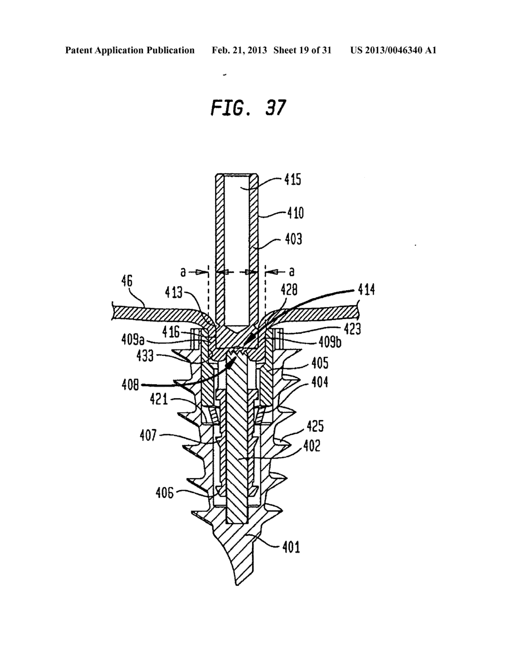 MEDICAL DEVICE AND PROCEDURE FOR ATTACHING TISSUE TO BONE - diagram, schematic, and image 20