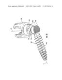 SPINAL FIXATION SYSTEM diagram and image