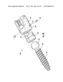 SPINAL FIXATION SYSTEM diagram and image