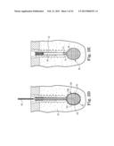 FIXATION SYSTEM FOR ORTHOPEDIC DEVICES diagram and image